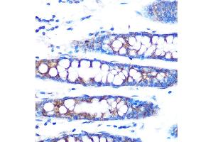 Immunohistochemistry of paraffin-embedded human colon using BMP4 Rabbit mAb (ABIN7265898) at dilution of 1:100 (40x lens). (BMP4 Antikörper)