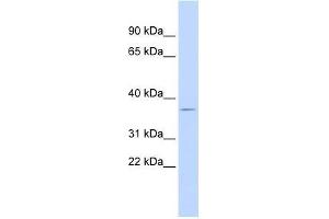 Western Blot showing DUSP12 antibody used at a concentration of 1-2 ug/ml to detect its target protein. (DUSP12 Antikörper  (N-Term))