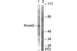 Western blot analysis of extracts from HepG2 cells, using Smad2 (Ab-467) Antibody. (SMAD2 Antikörper  (AA 418-467))