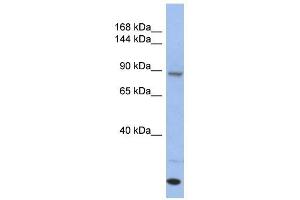 UNC45A antibody used at 1 ug/ml to detect target protein. (UNC45A Antikörper)