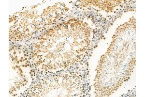 Phospho-Ki67 (Thr1335) Antibody at 1/100 staining Rat testis tissue by IHC-P. (Ki-67 Antikörper  (pThr1335))