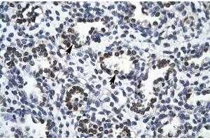 Rabbit Anti-RBM10 Antibody Catalog Number: ARP30103 Paraffin Embedded Tissue: Human Lung Cellular Data: Alveolar cells Antibody Concentration: 4. (RBM10 Antikörper  (N-Term))