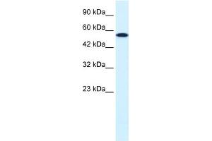 WB Suggested Anti-CHEK1 Antibody Titration:  0. (CHEK1 Antikörper  (Middle Region))