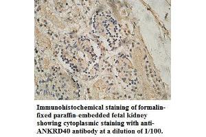 Image no. 1 for anti-Ankyrin Repeat Domain 40 (ANKRD40) antibody (ABIN1574706) (ANKRD40 Antikörper)
