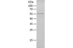 IFIH1 Protein (AA 700-1025) (His-IF2DI Tag)