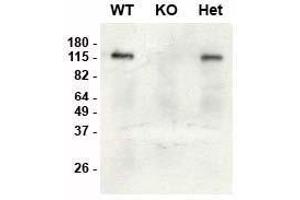 Immunoblot versus brain lysates from SAP97 wild-type (WT), knockout (KO) and heterozygous (Het) adult mice using K64/15 pure at 1 μg/mL (data courtesy of Lauren Makuch and Dr.