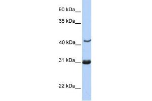 NUP35 antibody used at 1 ug/ml to detect target protein. (NUP35 Antikörper  (C-Term))