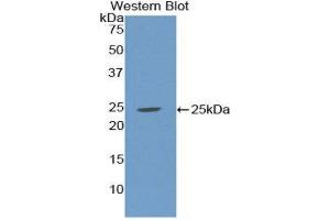 Western Blotting (WB) image for anti-Sex Hormone Binding Globulin (SHBG) (AA 224-388) antibody (ABIN1172834) (SHBG Antikörper  (AA 224-388))