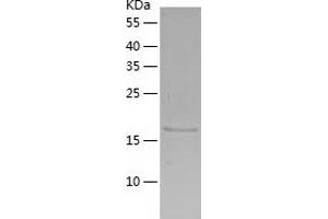 Lin-7 Homolog C (LIN7C) (AA 1-197) protein (His-IF2DI Tag)