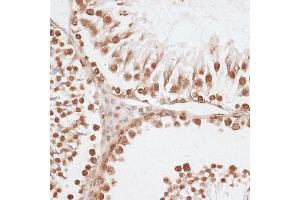 Immunohistochemistry of paraffin-embedded rat testis using Histone H2AX antibody (ABIN7267725) at dilution of 1:100 (40x lens).