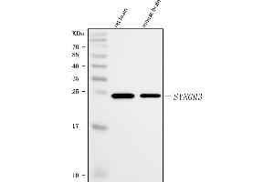 Western blot analysis of Synaptogyrin 3/SYNGR3 using anti-Synaptogyrin 3/SYNGR3 antibody (ABIN7601760).