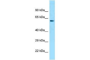 WB Suggested Anti-ZNF238 Antibody Titration: 1. (ZNF238 Antikörper  (N-Term))