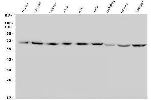 Western blot analysis of SLC2A9 using anti-SLC2A9 antibody (ABIN7602338).