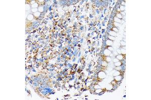 Immunohistochemistry of paraffin-embedded human appendix using CDC25B Rabbit mAb (ABIN7266250) at dilution of 1:100 (40x lens). (CDC25B Antikörper)