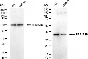 Western blotting analysis using PPP1R1B antibody (ABIN7800018).