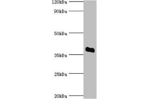 SULT2A1 Antikörper  (AA 1-145)