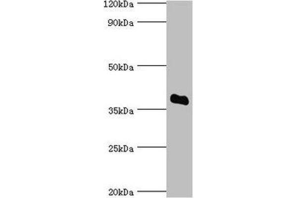 SULT2A1 antibody  (AA 1-145)