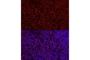 Immunofluorescence analysis of rat thymus cells using S Rabbit pAb (ABIN6130296, ABIN6147396, ABIN6147398 and ABIN6221485) at dilution of 1:50 (40x lens). (SATB1 Antikörper  (AA 484-763))
