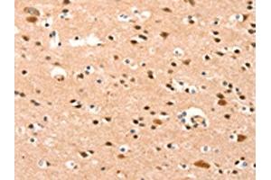 The image on the left is immunohistochemistry of paraffin-embedded Human brain tissue using ABIN7189955(BAZ1A Antibody) at dilution 1/25, on the right is treated with synthetic peptide. (BAZ1A Antikörper)