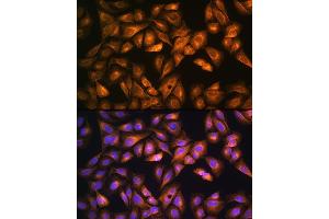 Immunofluorescence analysis of U2OS cells using SO Rabbit pAb (ABIN6129624, ABIN6148259, ABIN6148260 and ABIN6221917) at dilution of 1:100. (SOAT1 Antikörper  (AA 1-130))