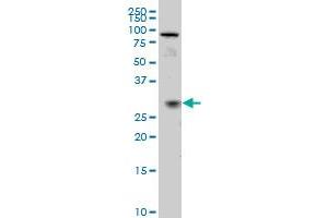 TGIF2 monoclonal antibody (M02), clone 5B11 Western Blot analysis of TGIF2 expression in IMR-32 . (TGIF2 Antikörper  (AA 131-236))