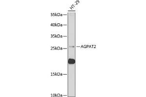 Western blot analysis of extracts of HT-29 cells, using  antibody (ABIN6129825, ABIN6136640, ABIN6136641 and ABIN6222174) at 1:1000 dilution. (AGPAT2 Antikörper  (AA 199-278))