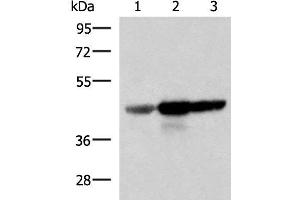 Western blot analysis of Human fetal brain tissue HepG2 and HT29 cell lysates using FDFT1 Polyclonal Antibody at dilution of 1:1000 (FDFT1 Antikörper)