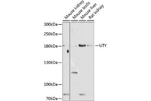 Western blot analysis of extracts of various cell lines, using UTY antibody (ABIN6132937, ABIN6150042, ABIN6150043 and ABIN6224660) at 1:1000 dilution. (UTY Antikörper  (AA 1-70))