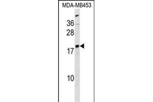 LYPLA1 Antibody (Center) (ABIN1538556 and ABIN2838111) western blot analysis in MDA-M cell line lysates (35 μg/lane).