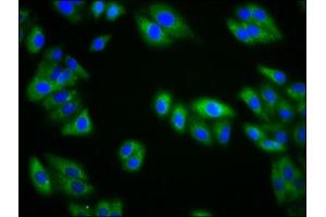 Immunofluorescence staining of HepG2 cells with ABIN7157546 at 1:133, counter-stained with DAPI. (KIRREL3 Antikörper  (AA 200-343))