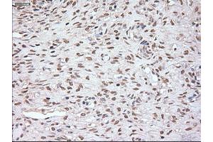 Immunohistochemistry (IHC) image for anti-Noggin (NOG) (AA 28-232) antibody (ABIN1491316) (NOG Antikörper  (AA 28-232))