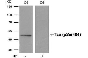 Western blot analysis of extracts from C6 cells, treated with calf intestinal phosphatase (CIP), using Tau (Phospho-Ser404) Antibody. (MAPT Antikörper  (pSer404))
