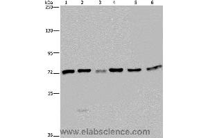 Western blot analysis of K562, A549, HT-29, 293T, Hela and Jurkat cell, using KARS Polyclonal Antibody at dilution of 1:350 (KARS Antikörper)