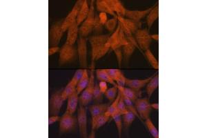 Immunofluorescence analysis of NIH-3T3 cells using K48-linkage Specific Ubiquitin Rabbit mAb (ABIN1680189, ABIN3017871, ABIN3017872 and ABIN7101530) at dilution of 1:100 (40x lens). (Ubiquitin B Antikörper)