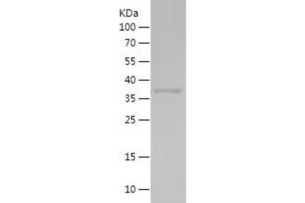 MAP1LC3A Protein (AA 1-120) (His-IF2DI Tag)