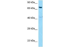 WB Suggested Anti-NCOA5 Antibody Titration: 1. (NCOA5 Antikörper  (Middle Region))