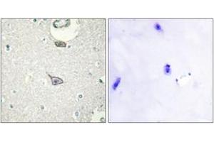 Immunohistochemistry analysis of paraffin-embedded human brain tissue, using CADM4 Antibody. (Cell Adhesion Molecule 4 Antikörper  (AA 339-388))