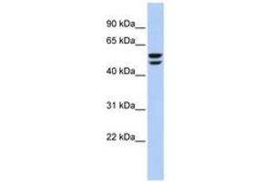 Image no. 1 for anti-ATPase, H+ Transporting, Lysosomal 56/58kDa, V1 Subunit B2 (ATP6V1B2) (AA 35-84) antibody (ABIN6744045) (ATP6V1B2 Antikörper  (AA 35-84))