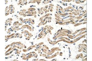 ALDH4A1 antibody was used for immunohistochemistry at a concentration of 4-8 ug/ml. (ALDH4A1 Antikörper  (C-Term))