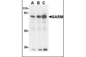 Western blot analysis of SARM in Daudi cell lysates with this product at (A) 0. (SARM1 Antikörper  (C-Term))