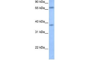 WB Suggested Anti-FEM1B Antibody Titration: 0. (FEM1B Antikörper  (Middle Region))