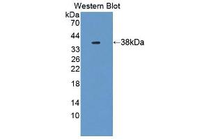 Western blot analysis of the recombinant protein. (UBAP1 Antikörper  (AA 1-295))