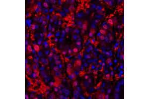 Immunofluorescence (IF) image for anti-Arginase, Liver (ARG1) (AA 1-322) antibody (ABIN7454020) (Rekombinanter Liver Arginase Antikörper  (AA 1-322))
