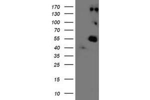 Western Blotting (WB) image for anti-Lysyl Oxidase (LOX) (AA 22-168) antibody (ABIN1491215) (LOX Antikörper  (AA 22-168))