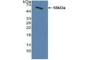 Western blot analysis of recombinant Human ADRbK1. (GRK2 Antikörper  (AA 398-640))