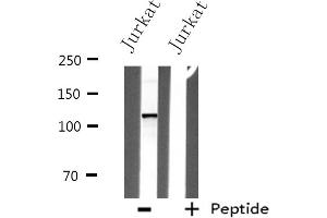 Western blot analysis of extracts from Jurkat cells, using ITPKB antibody. (ITPKB Antikörper  (Internal Region))