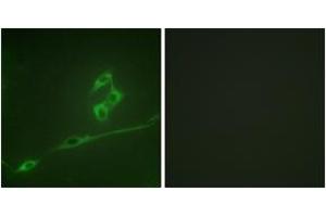 Immunofluorescence analysis of NIH-3T3 cells, using p70 S6 Kinase (Ab-371) Antibody. (RPS6KB1 Antikörper  (AA 337-386))