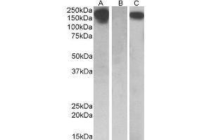 HEK293 lysate (10ug protein in RIPA buffer) overexpressing Human CSF1R with C-terminal MYC tag probed with ABIN2562031 (0. (CSF1R Antikörper  (AA 700-710))