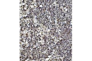 IHC analysis of MCPIP1/ZC3H12A using anti-MCPIP1/ZC3H12A antibody (ABIN7601482).