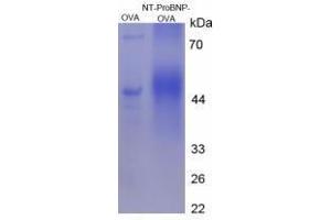 Image no. 3 for Pro-Brain Natriuretic Peptide (NT-ProBNP) (NT-ProBNP) (AA 45-60), (N-Term) peptide (Ovalbumin) (ABIN5666286) (Pro-Brain Natriuretic Peptide (NT-ProBNP) (NT-ProBNP) (AA 45-60), (N-Term) peptide (Ovalbumin))